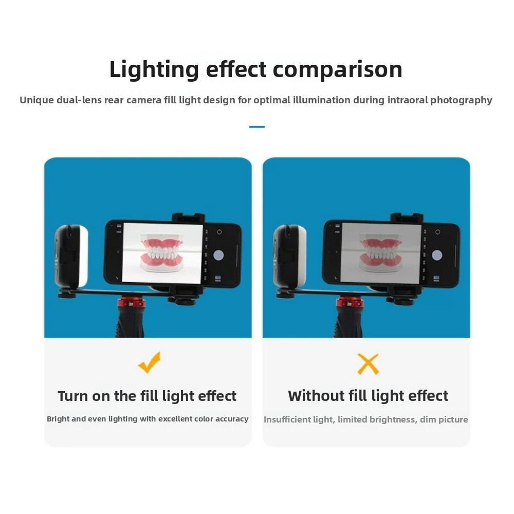 Dental Photography Light, Blue - Photography Basics review and price